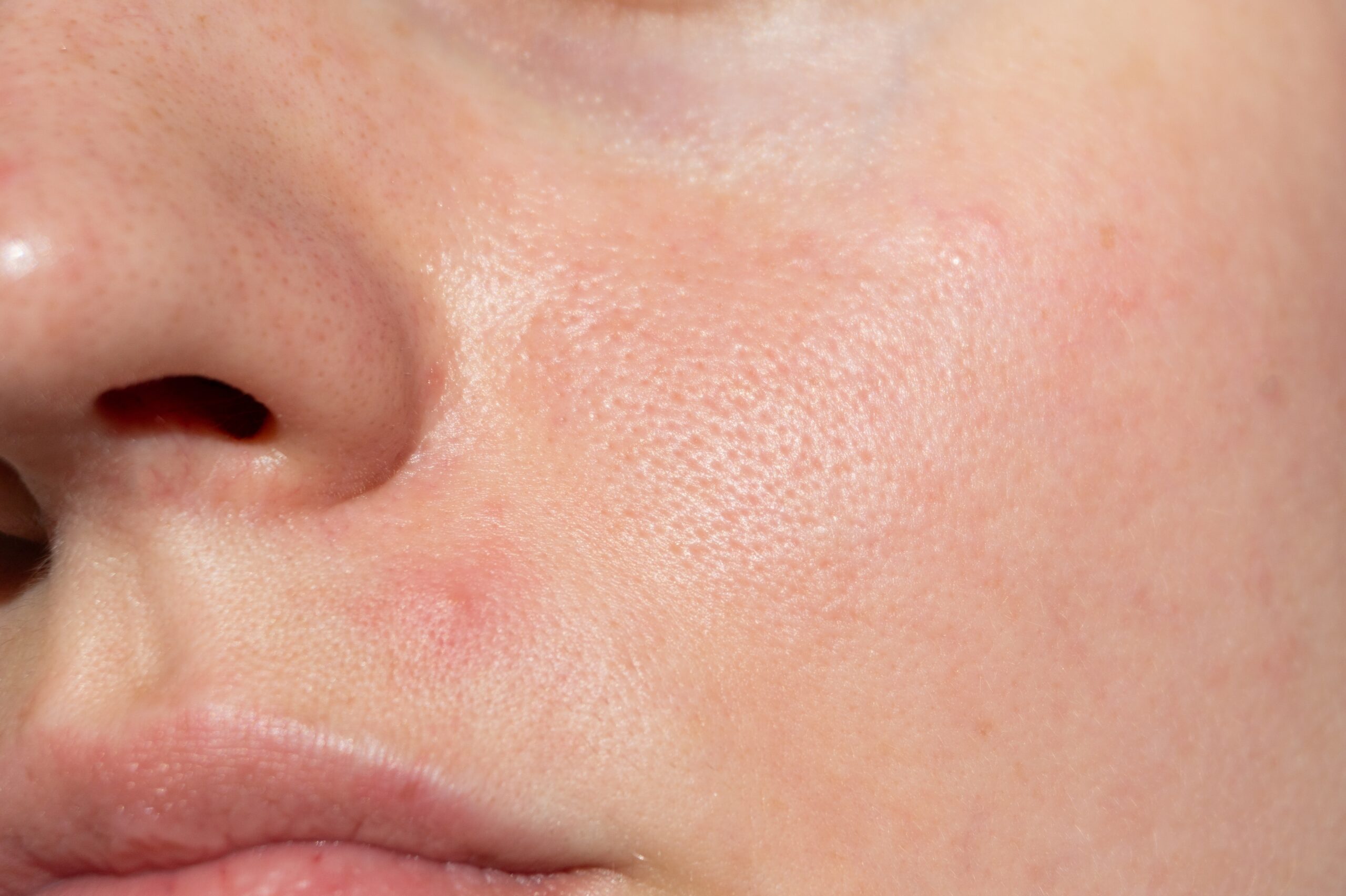 how to identify your skin type